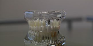 Implant dentar