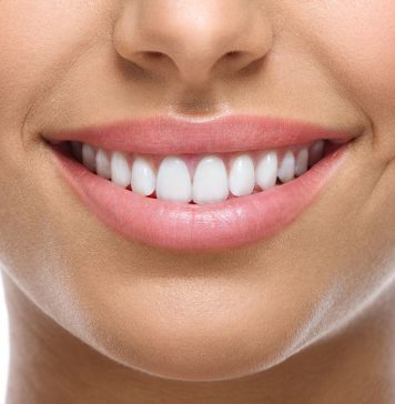 implant dentar