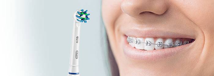 tipuri de aparate dentare