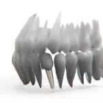 Implanturile dentare