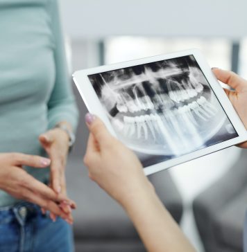implant dentar