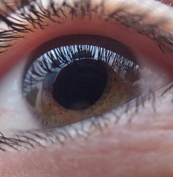 Ce trebuie să știi despre cataractă: cauze, simptome și tratament Cataracta