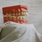 Proteze-dentare-în-sector-2